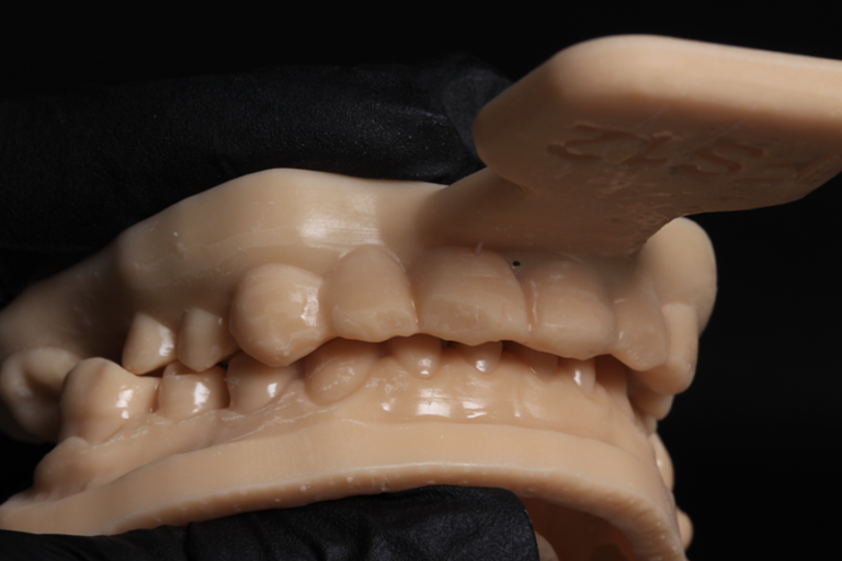 Modelo dentário impresso em 3D no laboratório da FS